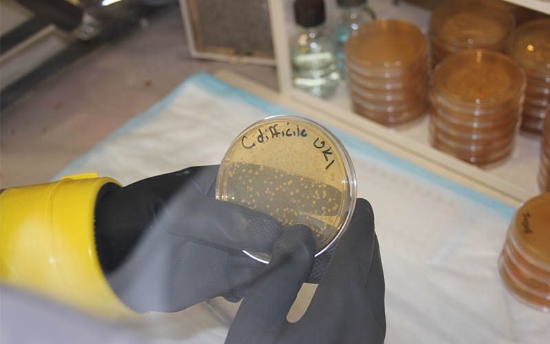 Texas A&M-Led Research Rules Out Secondary Bile Acids as Protector Against C Diff