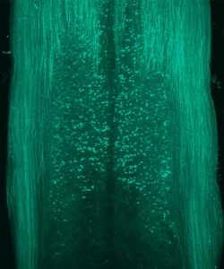 turqouise stain of neural cells