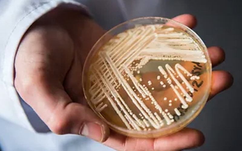 hand holding bacteria petri dish