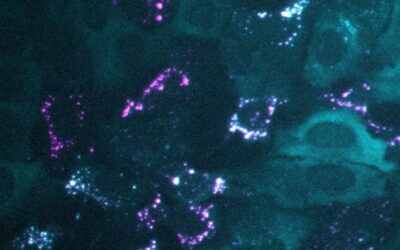 human cells cyan stain with magenta virus