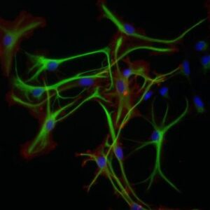cultured astrocytes in green microscopic image