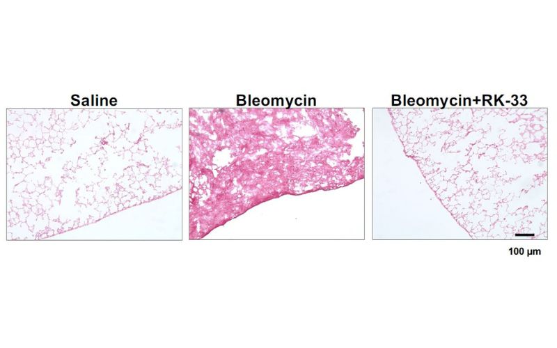 Sections of lungs tissue: red staining is tissue, and the white areas are the airspaces in the lungs.