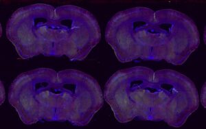 color image of purple tissue