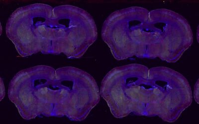 color image of purple tissue