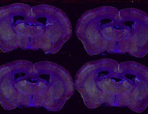 Decoding the Brain’s Internal Clock, and What Happens When It Breaks?